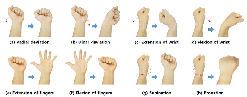 Desk Related Wrist Pain - Causes, Symptoms, Nerves